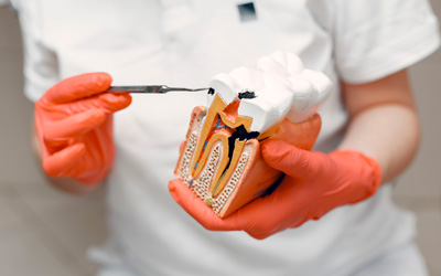 Endodontia