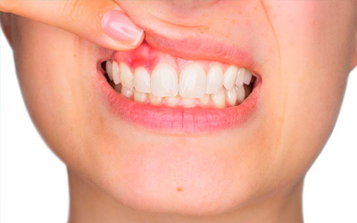 Periodontia